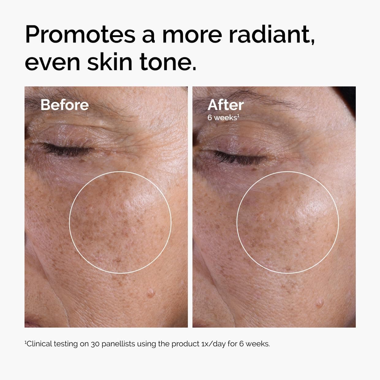 The Ordinary Glycolic Acid 7% Exfoliating Toner, Brightening and Smoothing Daily Toner for More Even-Looking Skin Tone thumbnail 2
