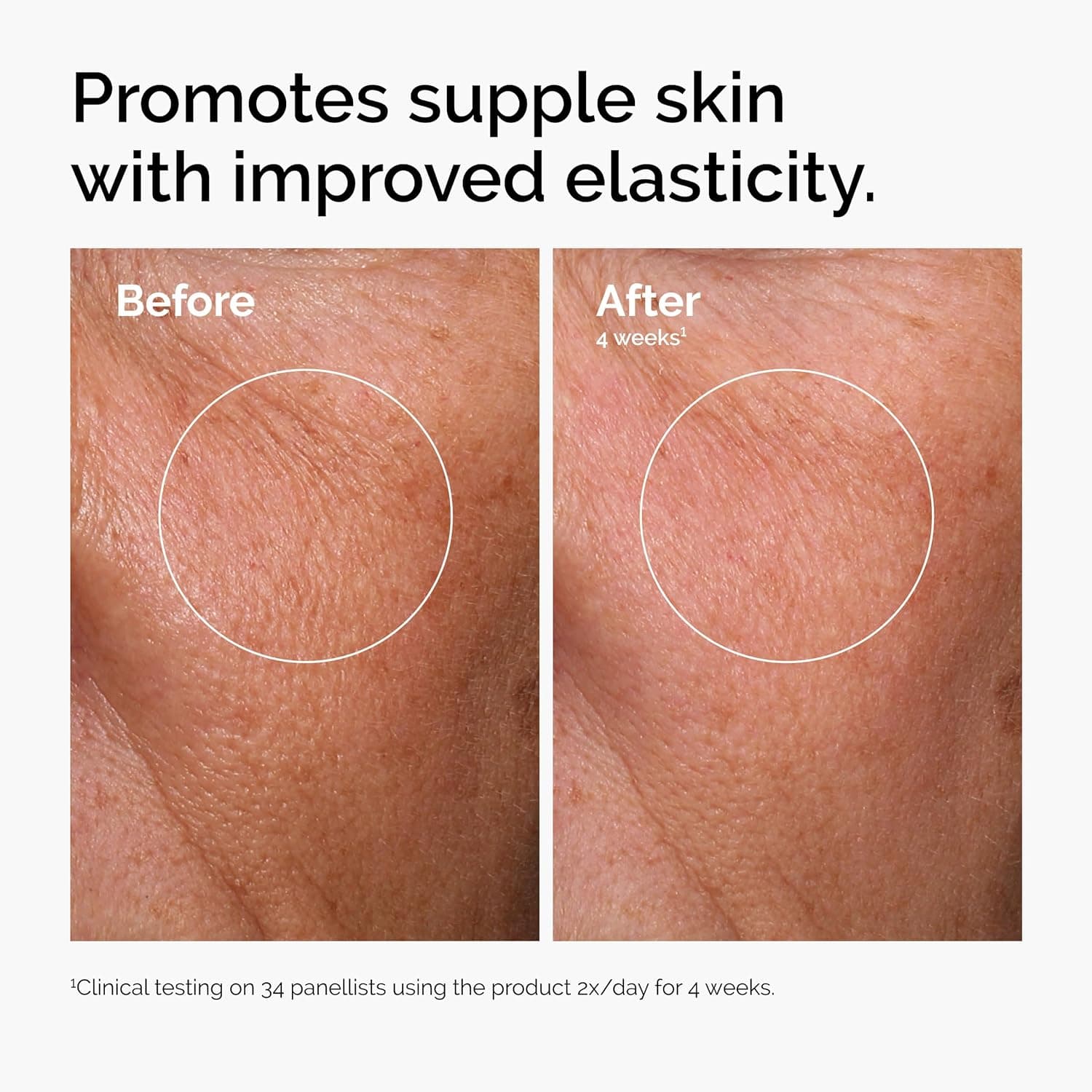 The Ordinary Hyaluronic Acid 2% + B5 (with Ceramides), Multi-Depth Hydration Serum for Plumper, Smoother Skin thumbnail 2